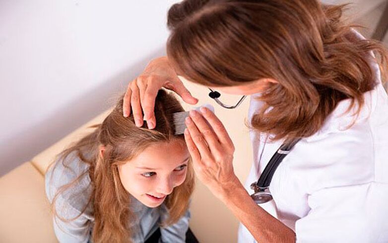fej psoriasisának kezelése gyermekeknél